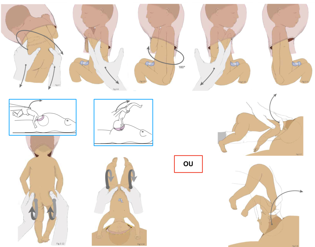 Schema des méthodes pour le siège