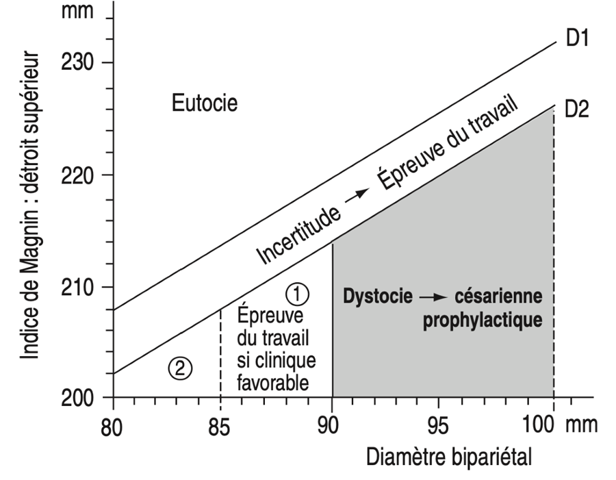 Diagramme de disproportion céphalo-pelvienne selon Magnin.
En vertical indice de Magnin, détroit supérieur.
Ligne horizontale : Diamètre bipariétal