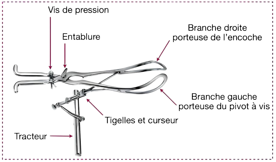 Schéma explicatif du forcep de Tarnier